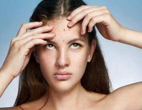 一直長痘痘和家中養(yǎng)花有關(guān)系嗎