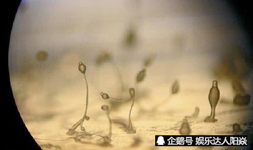 家里養(yǎng)花有霉菌會致癌