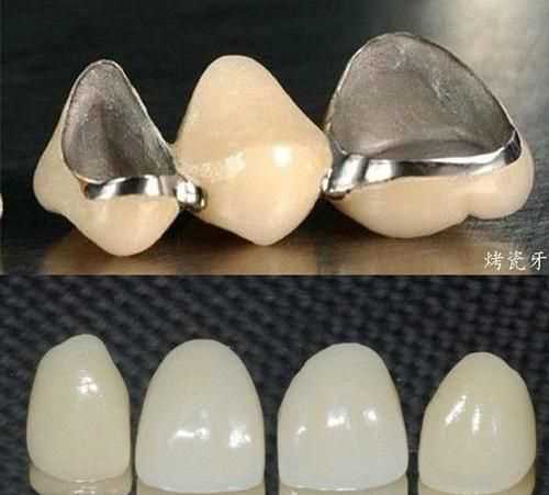 牙音和齒音的區(qū)別