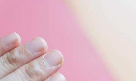 手起倒刺吃什么維生素,手指上長倒刺是因為缺乏維生素嗎圖7