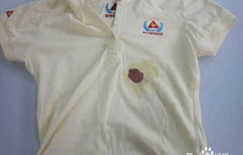 怎么洗掉白色衣服上的血跡