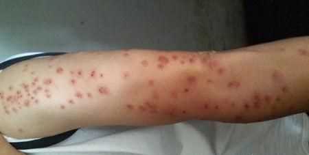 臭蟲(chóng)在水里泡多久才會(huì)死，家里有臭蟲(chóng)，怎么樣才能快速除掉呢？圖4