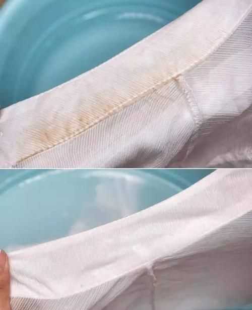 白色衣服上的頑固污漬怎么去除