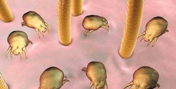 螨蟲多少度高溫能殺死,螨蟲在多少溫度下能死亡?圖1