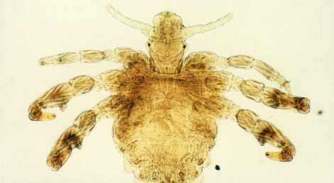 陰虱會(huì)在被子存活,陰虱在床單上能活多久