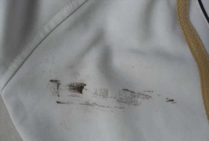 衣服血漬清洗小妙招