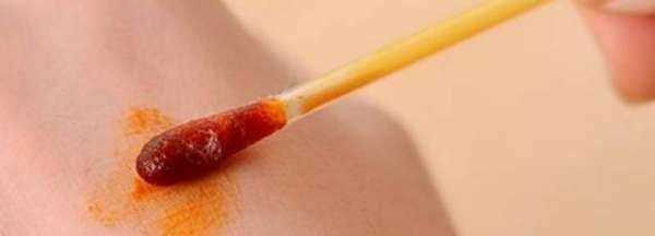 碘伏可以帶上高鐵,碘伏可以帶上高鐵嗎圖3