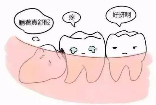 智齒到底要不要拔