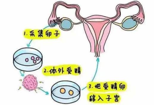 試管嬰兒怎么做的全過程