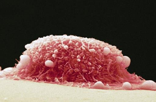 女性hpv真實(shí)圖片