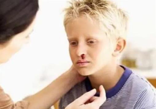 白血病的發(fā)燒規(guī)律5大征兆 白血病的發(fā)燒規(guī)律5大征兆