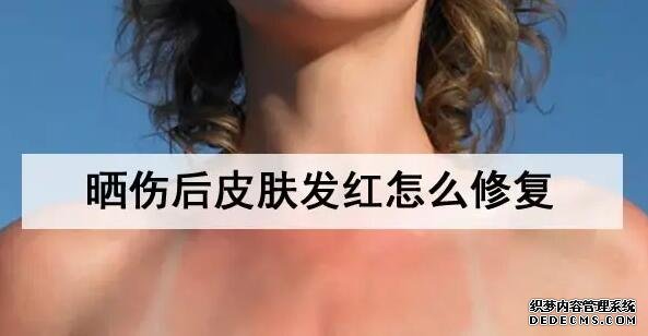 曬傷后皮膚發(fā)紅怎么修復(fù) 曬傷后皮膚發(fā)紅怎么修復(fù)