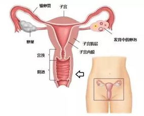 可以讓人流產(chǎn)的方法有哪些問(wèn)題