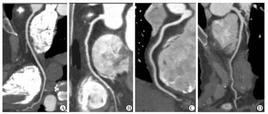 ct掃描方法都有哪些