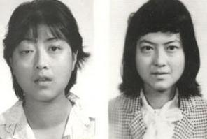 測(cè)試甲亢方法有哪些