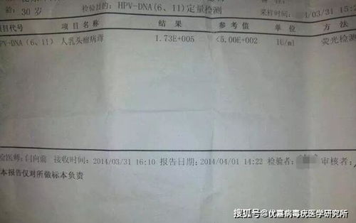 hp18陽性的治療方法有哪些