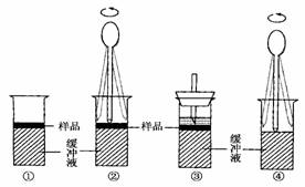去除樣品中蛋白質(zhì)的方法有哪些