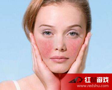 怎樣可以去臉上的紅血絲的方法有哪些