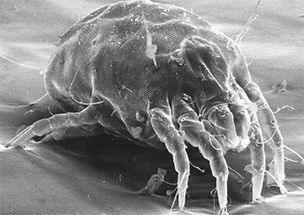 活螨的檢查方法有哪些