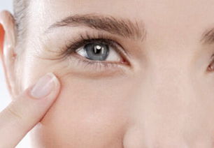 魚尾紋祛鄒方法有哪些