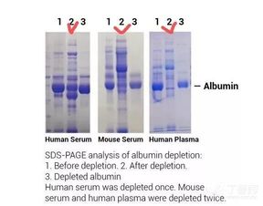 去除血漿蛋白質(zhì)的方法有哪些