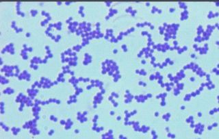 細(xì)菌分類傳統(tǒng)方法有哪些