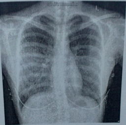 脊柱檢查的方法和內(nèi)容有哪些