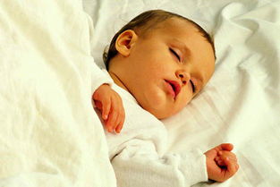 新生兒黃疸指數(shù)高有哪些治療方法