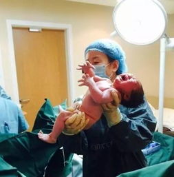 哪些方法能促進分娩發(fā)動