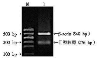 提取動(dòng)物rna的方法有哪些