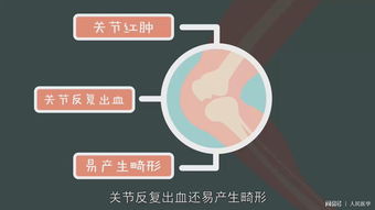 血友病的最新治療方法有哪些