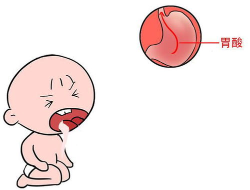 嘔吐可以使用哪些方法處理