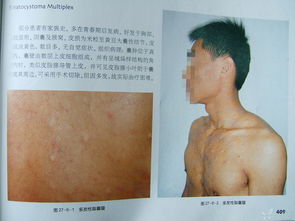 腫瘤非手術(shù)方法有哪些