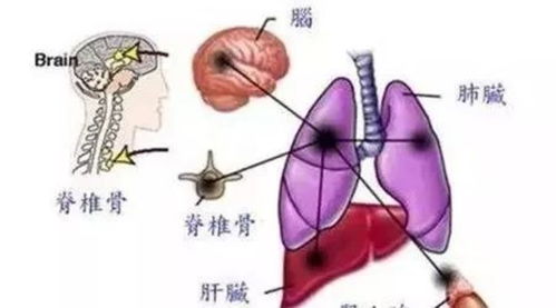 胃癌怎么治療是最好的方法有哪些