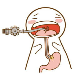 胃病不檢查方法有哪些