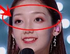 治療眼癤子有哪些方法