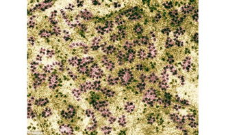 蛋白除鹽有哪些方法