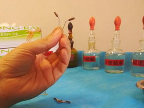 除了帶環(huán)還有哪些避孕方法