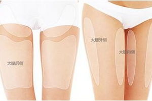 吸脂手術好方法有哪些方法有哪些