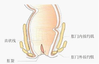 肛裂有效治療方法有哪些