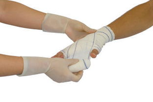 止血的方法有哪些地方