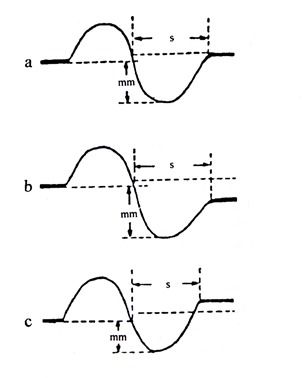 測量的標(biāo)準(zhǔn)方法有哪些