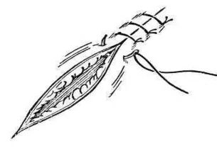 單純縫合方法有哪些