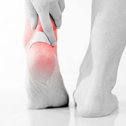 腳后跟骨刺的最佳治療方法有哪些