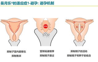 女性避孕有哪些方法有哪些方法