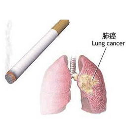 治肺癌藥物有哪些方法有哪些方法