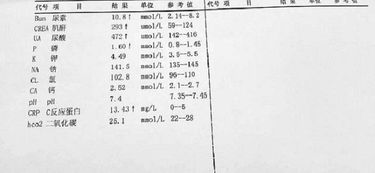 安陽治療肌酐好的方法有哪些