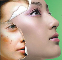 福州治療黃褐斑方法有哪些