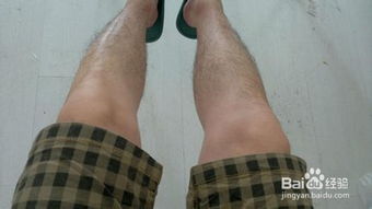 減少淡化腿毛的方法有哪些