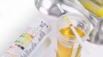 正確留取檢驗(yàn)標(biāo)本須知(正確留取檢驗(yàn)標(biāo)本須知)